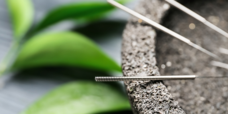buscar-especialista-en-terapia-de-acupuntura