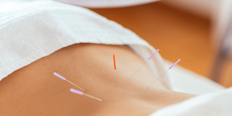 clinica-de-acupuntura-cerca-de-mi