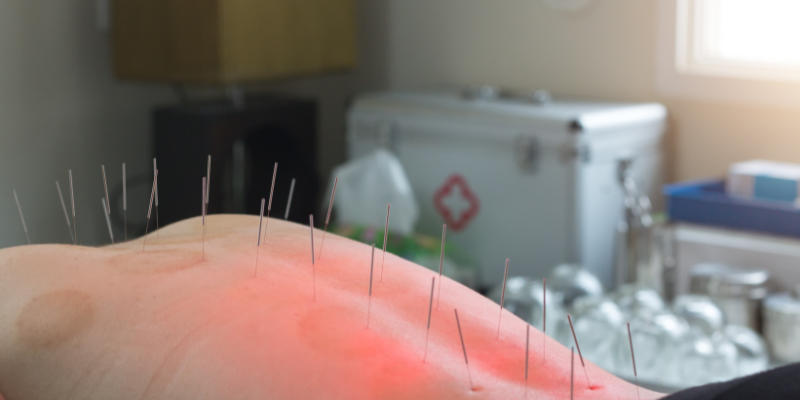 clinica-de-acupuntura-y-salud