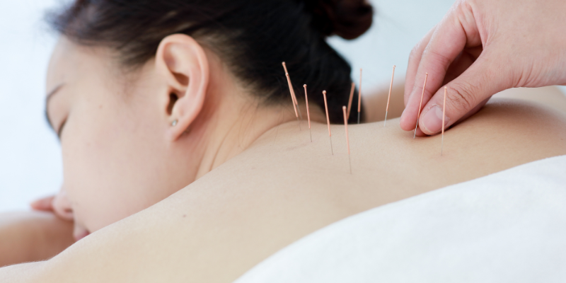 doctora-acupunturista-en-iztapalapa