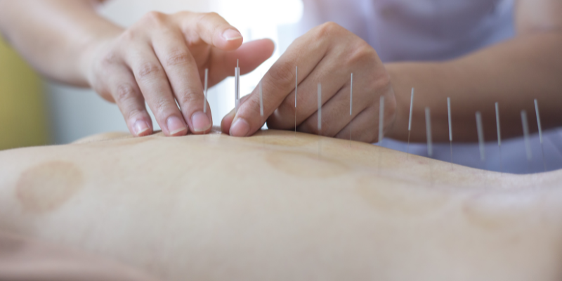 los-mejores-medicos-acupunturistas
