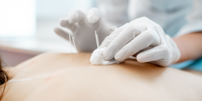 medico-acupunturista-cerca-de-mi-ubicacion